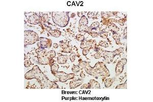 Sample Type :  Human placental tissue   Primary Antibody Dilution :   1:50  Secondary Antibody :  Goat anti rabbit-HRP   Secondary Antibody Dilution :   1:10,000  Color/Signal Descriptions :  Brown: CAV2 Purple: Haemotoxylin  Gene Name :  CAV2  Submitted by :  Dr.