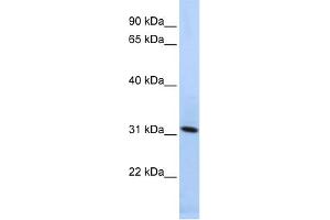 WB Suggested Anti-SYNGR4 Antibody Titration:  0. (SYNGR4 antibody  (N-Term))
