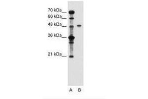 Image no. 2 for anti-Solute Carrier Family 39 (Zinc Transporter), Member 6 (SLC39A6) (AA 26-75) antibody (ABIN205014) (SLC39A6 antibody  (AA 26-75))