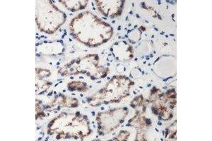 Immunohistochemical analysis of DMGDH staining in human kidney formalin fixed paraffin embedded tissue section. (DMGDH antibody  (C-Term))