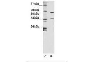 Image no. 1 for anti-Zinc Finger Protein 597 (ZNF597) (AA 48-97) antibody (ABIN6736181) (ZNF597 antibody  (AA 48-97))