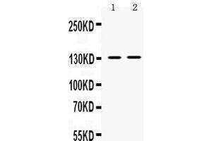 Western blot analysis of TRPM5 expression in SMMC whole cell lysates (lane 1) and 293T whole cell lysates (lane 2).