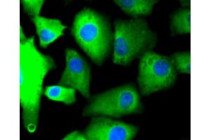 Immunofluorescence (IF) image for anti-Protein Kinase C, alpha (PKCa) antibody (ABIN4904772)