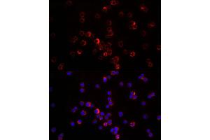 Immunofluorescence analysis of THP-1 cells using CXCL12 antibody (ABIN6130152, ABIN6139271, ABIN6139272 and ABIN6217180) at dilution of 1:200. (CXCL12 antibody  (AA 22-89))