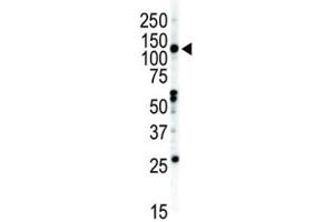 Western blot analysis of EphB2 antibody and NCI-H460 cell lysate. (EPH Receptor B2 antibody  (AA 1021-1050))