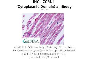 Image no. 2 for anti-Chemokine (C-C Motif) Receptor-Like 1 (CCRL1) (2nd Cytoplasmic Domain) antibody (ABIN1732791)