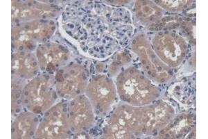 #VALUE! (LUC7-Like 3 antibody  (AA 1-247))