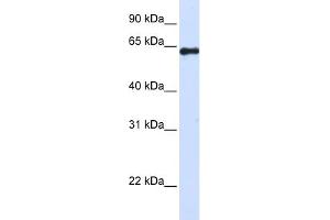 WB Suggested Anti-FAM116A Antibody Titration: 0. (FAM116A antibody  (Middle Region))