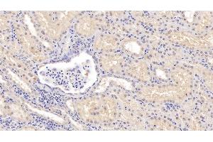 Detection of COMT in Human Kidney Tissue using Polyclonal Antibody to Catechol-O-Methyltransferase (COMT) (COMT antibody  (AA 52-271))