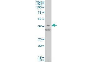 HIF1AN monoclonal antibody (M01), clone 1D8 Western Blot analysis of HIF1AN expression in Jurkat . (HIF1AN antibody  (AA 1-349))