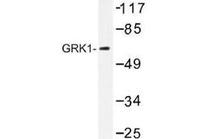 Image no. 1 for anti-G Protein-Coupled Receptor Kinase 1 (GRK1) antibody (ABIN317886)