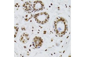 Immunohistochemistry of paraffin-embedded human breast using XRCC6 Antibody (ABIN5970325) at dilution of 1/100 (40x lens). (XRCC6 antibody)