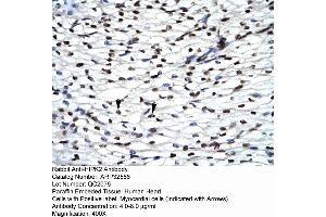 Rabbit Anti-HIPK2 Antibody  Paraffin Embedded Tissue: Human Heart Cellular Data: Myocardial cells Antibody Concentration: 4. (HIPK2 antibody  (Middle Region))