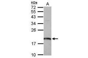 Image no. 1 for anti-ADP Ribosylation Factor Like GTPase 1 (ARL1) (AA 1-163) antibody (ABIN1496712) (ARL1 antibody  (AA 1-163))