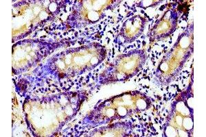 Immunohistochemistry of paraffin-embedded human small intestine tissue using ABIN7153569 at dilution of 1:100 (TUBGCP4 antibody  (AA 203-309))