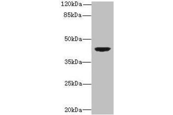 DAPK2 anticorps  (AA 222-370)