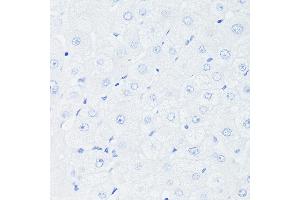 Immunohistochemistry of paraffin-embedded Human liver (negative control sample) using [KO Validated] p53 Rabbit mAb (ABIN7271080) at dilution of 1:100 (40x lens). (p53 antibody)