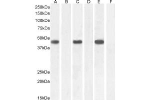Western Blotting (WB) image for anti-Forkhead Box L2 (FOXL2) (C-Term) antibody (ABIN185040)