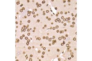 Immunohistochemistry (Paraffin-embedded Sections) (IHC (p)) image for anti-Lamin B2 (LMNB2) (AA 341-620) antibody (ABIN6143268)