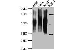 Western Blot Positive WB detected in: A549 whole cell lysate, Hela whole cell lysate, HepG2 whole cell lysate, MCF-7 whole cell lysate All lanes CD63 antibody at 1:1000 Secondary Goat polyclonal to mouse IgG at 1/50000 dilution Predicted band size: 30-120 KD KDa Observed band size: 30-120 KD KDa Exposure time:1 min (CD63 antibody  (AA 103-203))