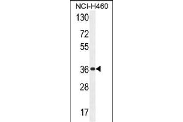 OR4A47 antibody  (C-Term)