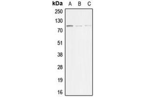 Western blot analysis of ACTN3 expression in HeLa (A), mouse muscle (B), rat muscle (C) whole cell lysates. (ACTN3 antibody  (N-Term))
