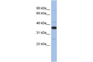 WB Suggested Anti-MYD88 Antibody Titration: 0. (MYD88 antibody  (Middle Region))