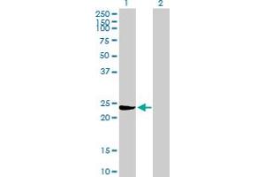 Western Blot analysis of GSTM3 expression in transfected 293T cell line by GSTM3 MaxPab polyclonal antibody.