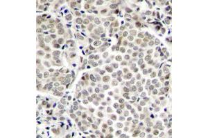 Immunohistochemistry (IHC) image for anti-Nuclear Factor-kB p65 (NFkBP65) (pSer529) antibody (ABIN1870581) (NF-kB p65 antibody  (pSer529))