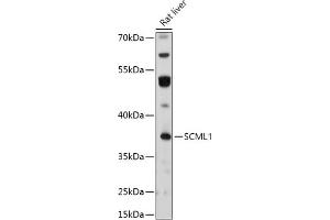Western blot analysis of extracts of Rat liver, using SCML1 antibody (ABIN7270268) at 1:1000 dilution. (SCML1 antibody  (AA 50-200))