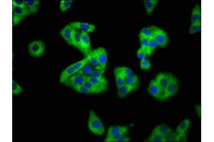 Immunofluorescence staining of HepG2 cells with ABIN7168797 at 1:100, counter-stained with DAPI. (SEMA4B antibody  (AA 163-253))