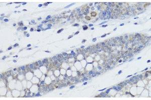 Immunohistochemistry of paraffin-embedded Human colon using MonoMethyl-Histone H4-K20 Polyclonal Antibody at dilution of 1:200 (40x lens). (Histone H4 antibody  (meLys20))