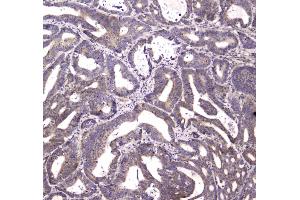 IHC analysis of HTRA1 using anti-HTRA1 antibody . (HTRA1 antibody)