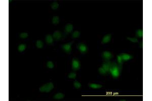 Immunofluorescence of monoclonal antibody to DPH1 on HeLa cell.