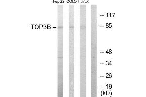 Western Blotting (WB) image for anti-Topoisomerase (DNA) III beta (TOP3B) (N-Term) antibody (ABIN1849086) (TOP3B antibody  (N-Term))