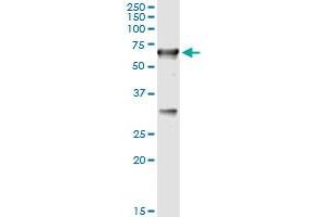 Immunoprecipitation of CBS transfected lysate using mouse monoclonal anti-CBS and Protein A Magnetic Bead (CBS (Human) IP-WB Antibody Pair)