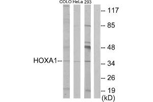 Western blot analysis of extracts from COLO cells, HeLa/ cells and 293 cells, using HOXA1 antibody. (HOXA1 antibody  (Internal Region))