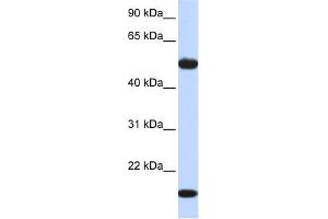 Human Muscle; WB Suggested Anti-ADSSL1 Antibody Titration: 0. (ADSSL1 antibody  (Middle Region))