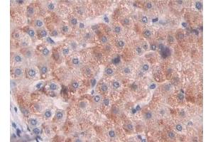 Immunohistochemistry (IHC) image for anti-Hypoxia Inducible Factor 1, alpha Subunit (Basic Helix-Loop-Helix Transcription Factor) (HIF1A) (AA 218-506) antibody (ABIN7439318)