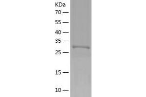 Western Blotting (WB) image for Zinc Finger Protein 417 (ZNF417) (AA 169-425) protein (His tag) (ABIN7288004) (ZNF417 Protein (AA 169-425) (His tag))