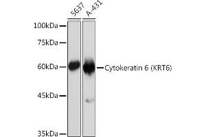 Western blot analysis of extracts of various cell lines, using Cytokeratin 6 (KRT6) (KRT6) Rabbit mAb (ABIN7268104) at 1:1000 dilution.