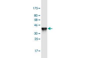 Western Blot detection against Immunogen (36. (Keratin 24 antibody  (AA 426-525))