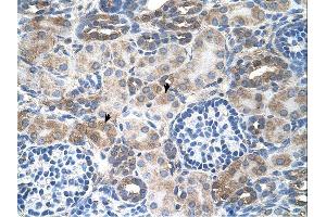 Immunohistochemistry (IHC) image for anti-Solute Carrier Family 14 (Urea Transporter), Member 1 (Kidd Blood Group) (SLC14A1) (C-Term) antibody (ABIN2783225) (SLC14A1 antibody  (C-Term))