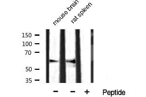 Western blot analysis of extracts of various tissue sample,using smad4 Antibody. (SMAD4 antibody  (N-Term))