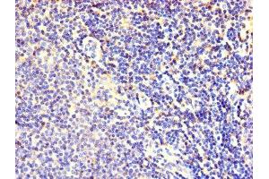 Immunohistochemistry of paraffin-embedded human lymphoid tissue using ABIN7152464 at dilution of 1:100 (FBXL18 antibody  (AA 1-365))