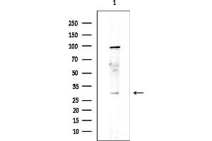 anti-TAF9B RNA Polymerase II, TATA Box Binding Protein (TBP)-Associated Factor, 31kDa (TAF9B) (N-Term) antibody