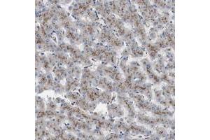 Immunohistochemical staining of human liver with NHLRC3 polyclonal antibody  shows strong cytoplasmic positivity with granular pattern in hepatocytes at 1:10-1:20 dilution. (NHLRC3 antibody)