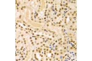 Immunohistochemistry of paraffin-embedded Mouse kidney using DKC1 antibody at dilution of 1:100 (x400 lens). (DKC1 antibody  (AA 245-514))