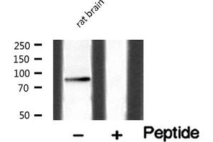 Western blot analysis of HGS expression in Rat brain lysate (HGS antibody  (Internal Region))