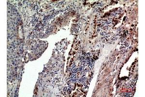 Immunohistochemistry (IHC) analysis of paraffin-embedded Human Lung, antibody was diluted at 1:100. (CD163L1 antibody  (Internal Region))